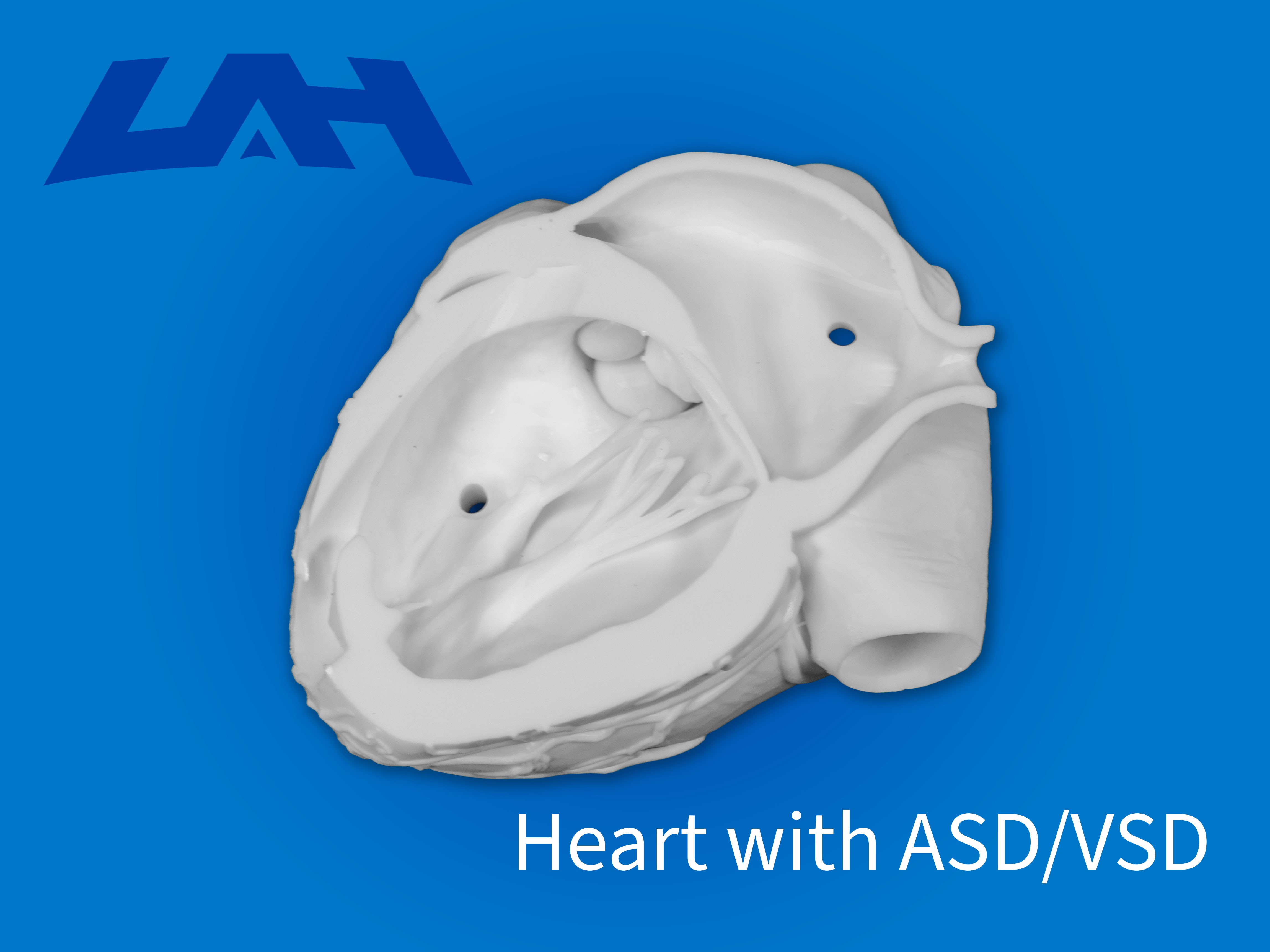 Heart with ASD/VSD