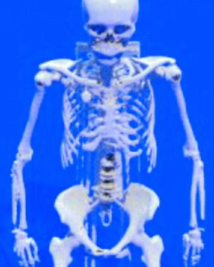 Whole Body (STL)