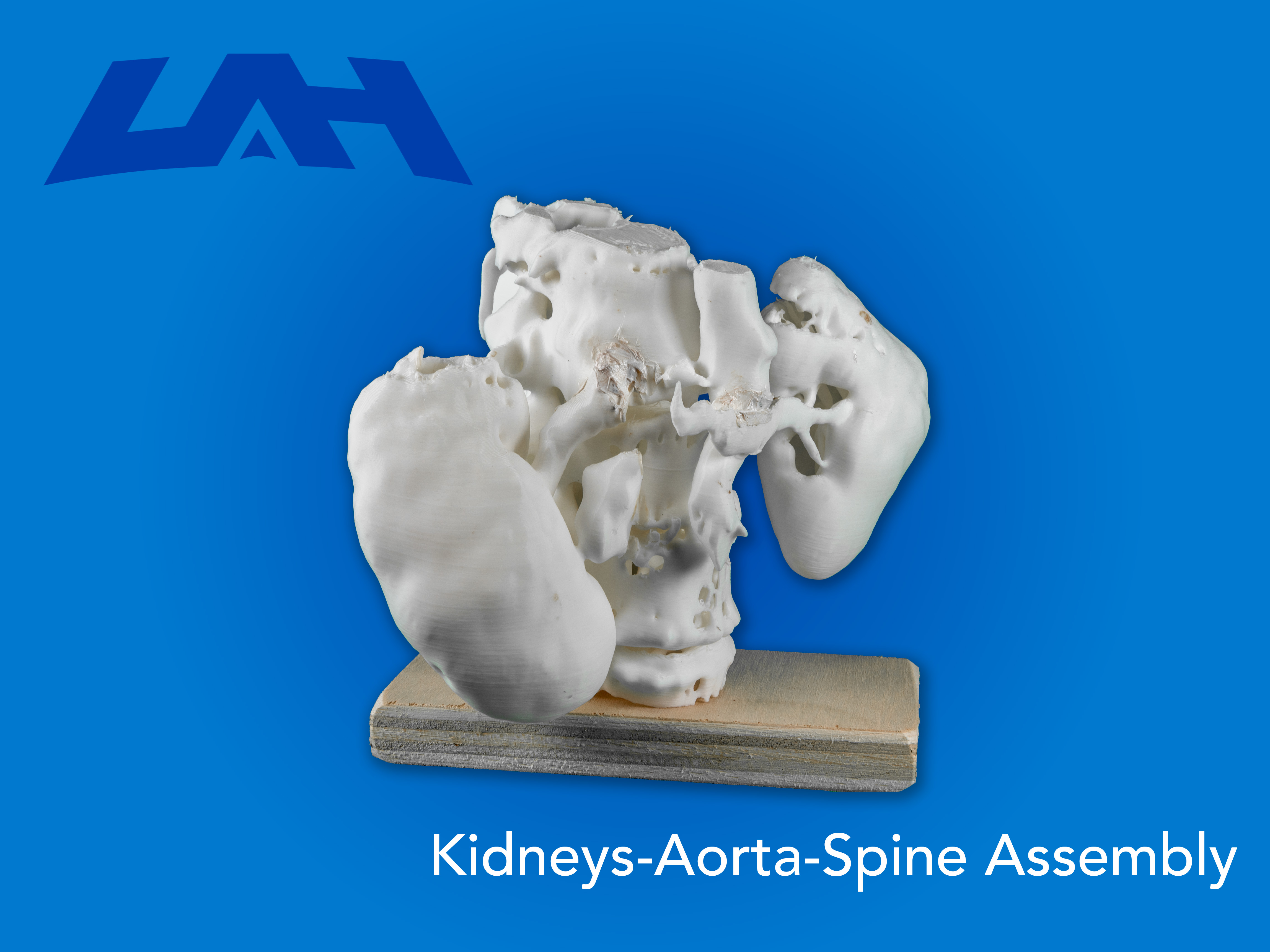 Kidneys-Aorta-Spine Assembly
