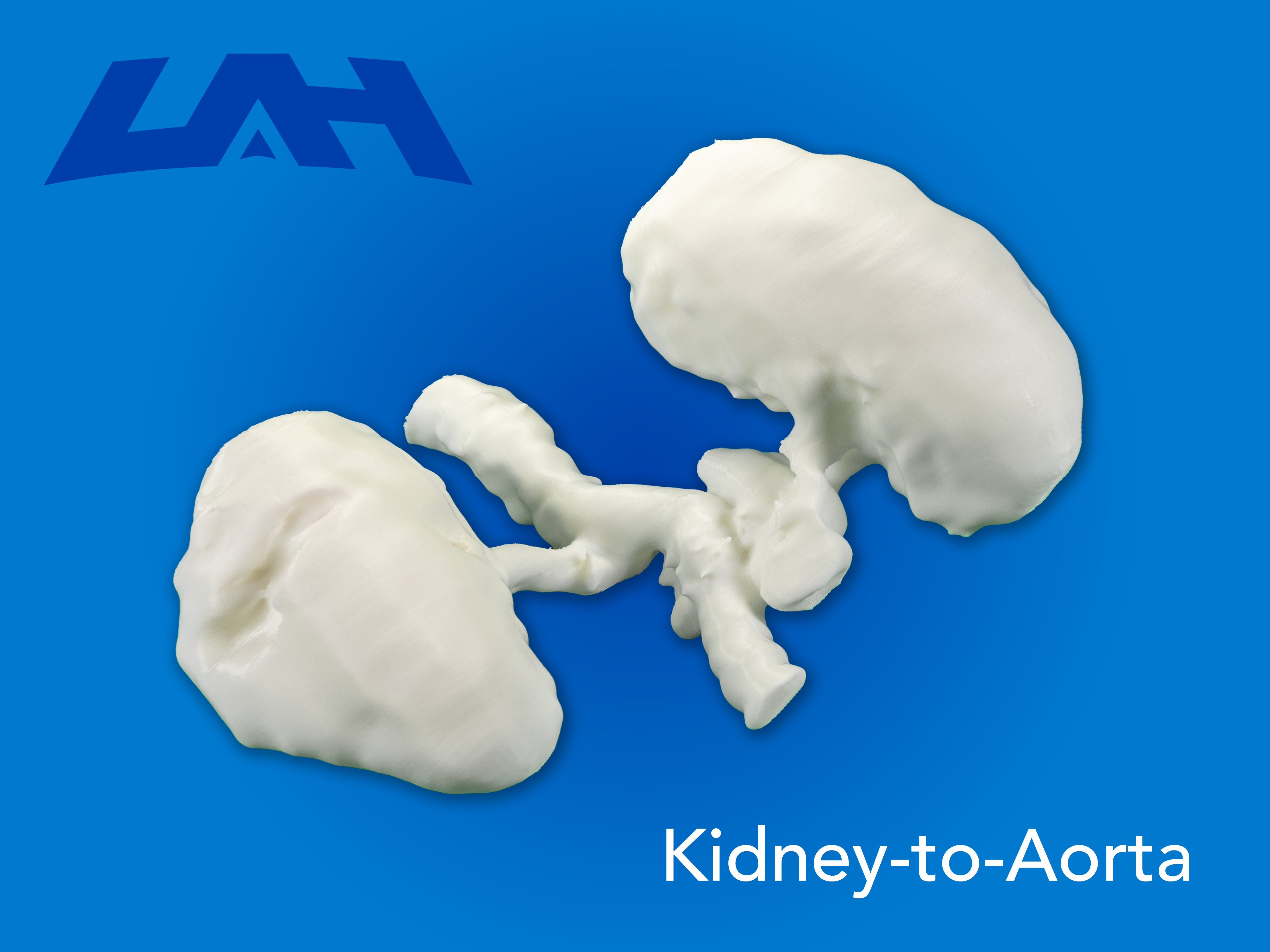 Kidney-to-Aorta