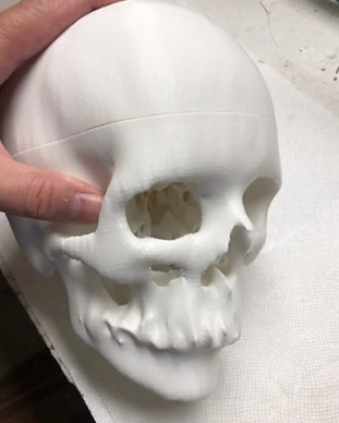 Skull