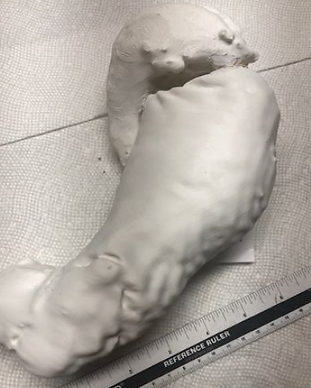 Stomach