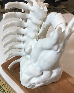 Heart-Aorta-Spine Assembly