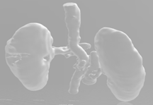 Kidney-to-Aorta