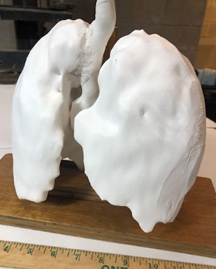 Lungs