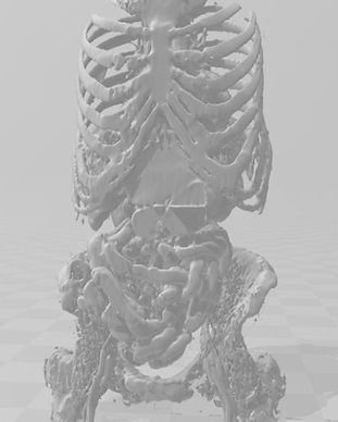 Whole Body(organs)